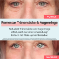 Remescar Tränensäcke &amp; dunkle Augenringe, 8ml